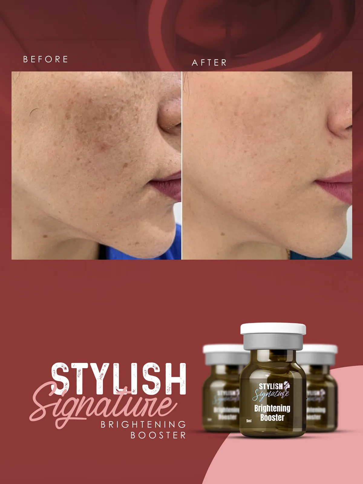 Brightning Booster results 1