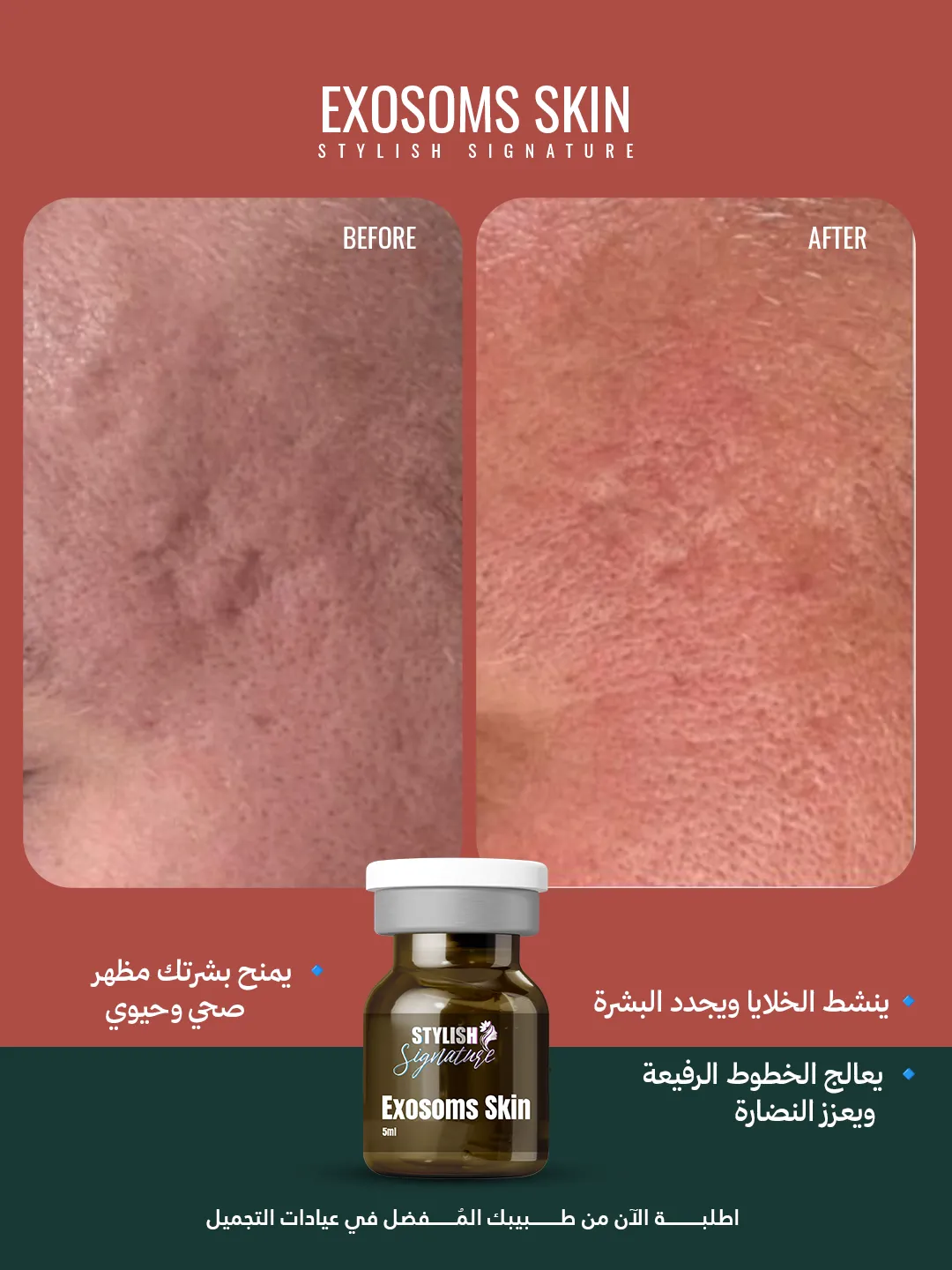 Exosoms Skin results 3