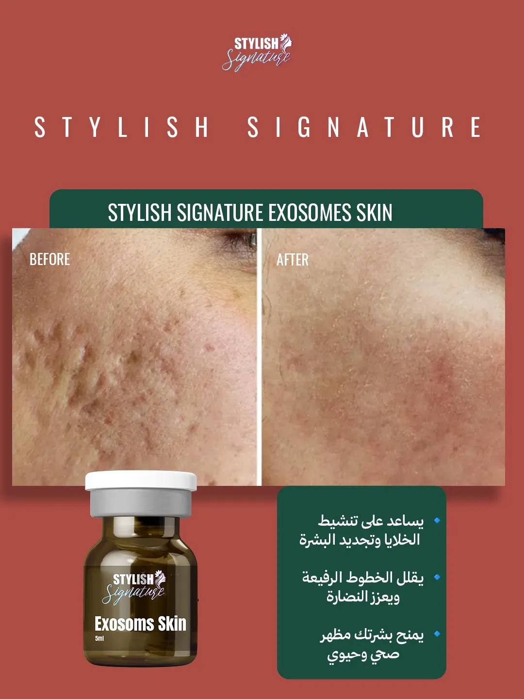 Exosoms Skin results 5